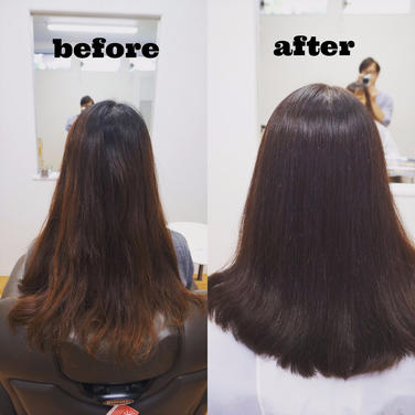 （左）施術前（右）施術後